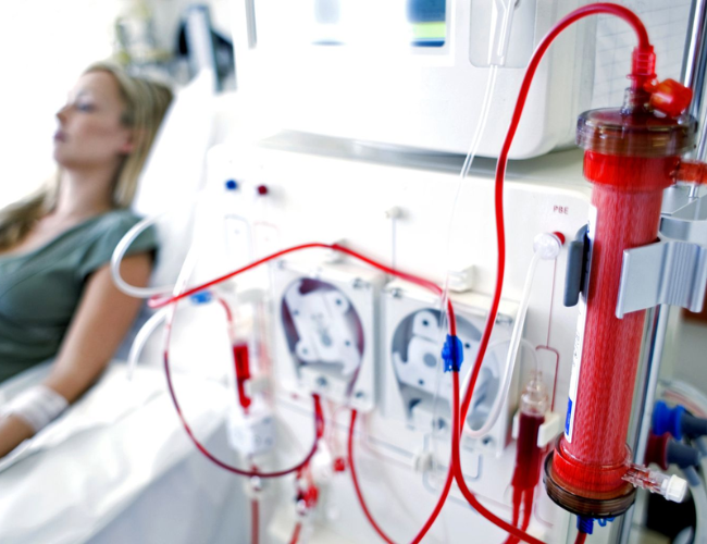 Hemodialysis at RPS Hospital