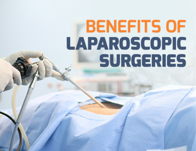 Laparoscopic Surgery